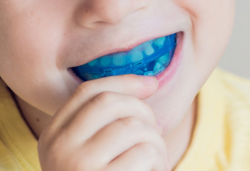 Orthodontic